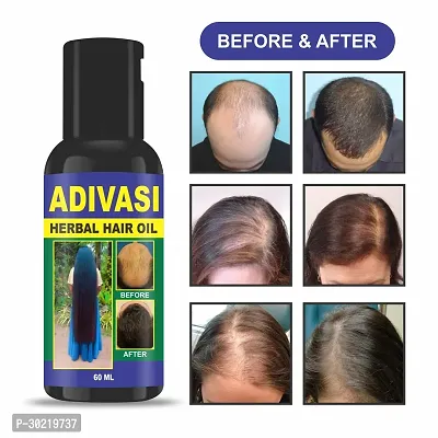 Classic Adivasi Herbal Hair Oil For All Type Of Hair Problem Growth Hair Oil 60 Ml,Pack Of 1-thumb3