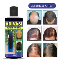 Classic Adivasi Herbal Hair Oil For All Type Of Hair Problem Growth Hair Oil 400Ml,Pack Of 4-thumb3