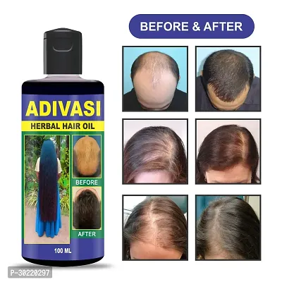 Classic Adivasi Herbal Hair Oil For All Type Of Hair Problem Growth Hair Oil 400Ml,Pack Of 4-thumb4