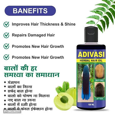 Classic Adivasi Herbal Hair Oil For All Type Of Hair Problem Growth Hair Oil 400Ml,Pack Of 4-thumb3