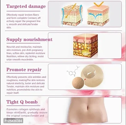 Kuraiy Best Repair Stretch Marks Removal - Natural Heal Pregnancy Breast, Hip, Legs-thumb2