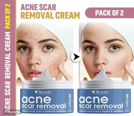 KURAIY Herbal Acne Treatment Cream Pimples Scar Removal Facial Cream Oil Control Shrink Pores Pack of 2