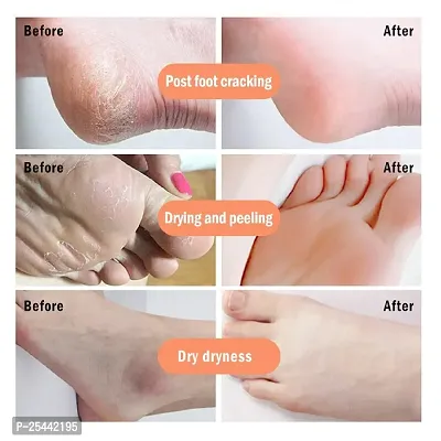 KURAIY Beautiful Crack Cream For Dry Cracked Heels  Feet.-thumb4