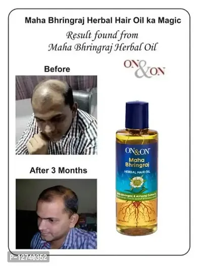 ON AND ON BRINGHA HERBAL HAIR REGROWTH OIL 200ML PACK OF 1-thumb0