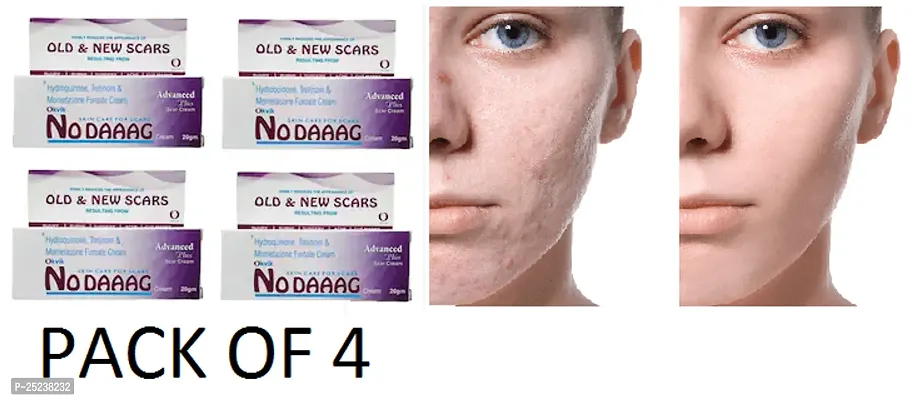 NO DAAAG SKIN CARE FOR SCARS PACK OF 4