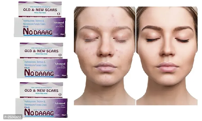 NO DAAAG SKIN CARE FOR SCARS PACK OF 3