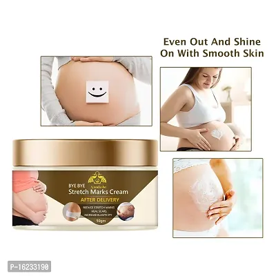 stretch marks cream after delivery