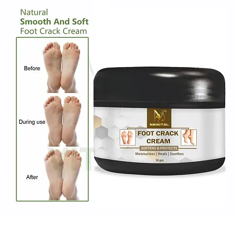 Best Quality Foot Care Cream