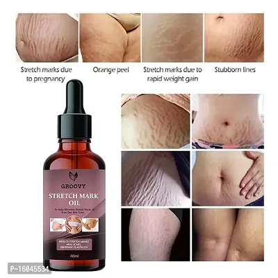 Groovy Premium pregnancy stretch marks removal oil 99% Natural origin Stretch Marks Oil  (40 ml)-thumb0