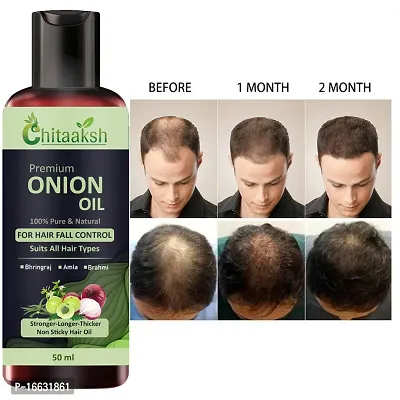 Chitaaksh Premium Onion for Hair fall control with Bhringraj , Amla, Bramhi for Strong, long Thick hair, Non Sticky formula 50ML-thumb0