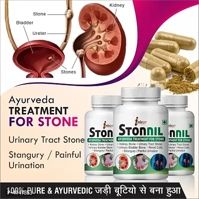 Stonnil Herbal Capsules For Primarily Used To Treat Kidney Stones 100% Ayurvedic Pack Of 3