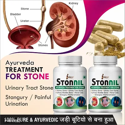 Stonnil Herbal Capsules For Primarily Used To Treat Kidney Stones 100% Ayurvedic Pack Of 2-thumb0