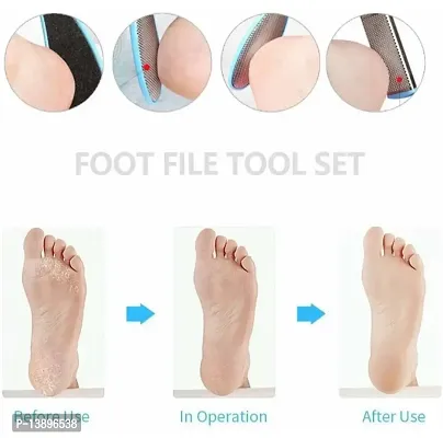 Professional Pedicure Tools Set, 26 in 1 Stainless Steel Foot Care Kit Foot  Rasp Dead Skin Remover, Foot File Kit Foot Callus Remover, for Men Women