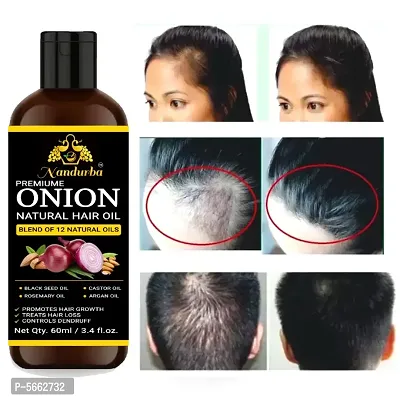 Combo of 2 onion hair oil(Pack of 2)(60ml+60ml)-thumb4