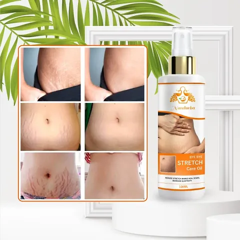Best Selling Stretch Mark Oil