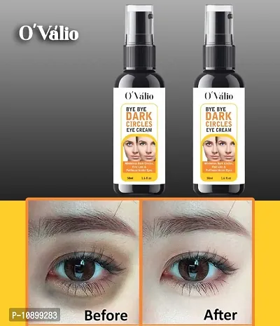Eyes Dark Circle Oil For Mens And Womens (Pack Of 2) (100ml)