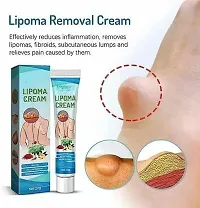 Chiwa Lipoma Removal Cream Lipoma Removal Cream Ointment Lipoma Elimination Cream for Lipoma Treatment Cellulite Removal Cream, Anti-Swelling Lymphatic Ointment (pack of 3)-thumb1