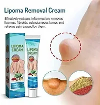 Chiwa Lipoma Removal Cream Whole Body Lipoma Lump Fat Removal-5 in 1 Lipstick Matte set 2-thumb1