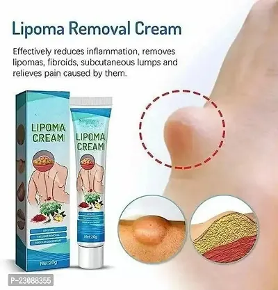 Chiwa Lipoma Removal Cream Whole Body Lipoma Lump Fat Removal-5 in 1 Lipstick Matte set 2-thumb2