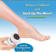 Pedi Vac For Foot Callus Remover Pedicure For Hard Cracked Skin Massager-thumb4