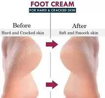 Natural Foot Cream For Rough Dry And Cracked Heel  Feet Cream For Heel Repair-thumb2