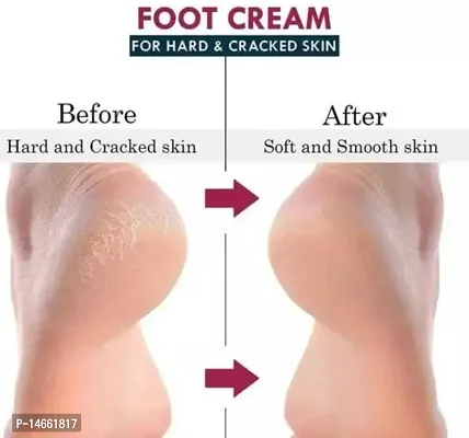 Natural Foot Cream For Rough Dry And Cracked Heel  Feet Cream For Heel Repair-thumb3