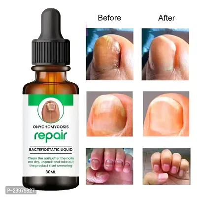 Natural Serum for Nail Strong 30 Ml Pack of 1-thumb0