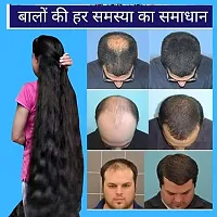 INPROVEDA Adivasi Herbal Hair Growth Oil Controls Hairfall Strong and Healthy Hair Repairs Frizzy Hair Nourishment - 200ml-thumb2