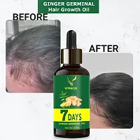 7 Days Ginger Oil for Hair Growth and Hair Fall Control-thumb2