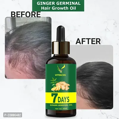 7 Days Ginger Oil for Hair Growth and Hair Fall Control-thumb3