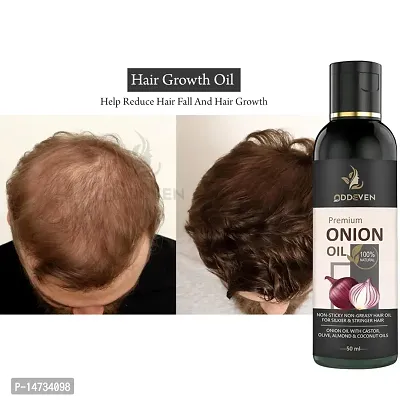 Onion Oil for Hair Growth with Omega-3; Peppermint  15 Essential oils ONION HAIR OIL (50ML) (PACK OF 1)-thumb0