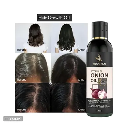 Onion Hair Oil 7 Day Challenge for Hair growth (Pack of 1) ONION HAIR OIL (50ML) (PACK OF 1)-thumb0