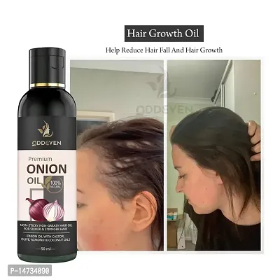 Red Onion Hair Oil with Keratin Protein booster, Nourishes hair follicles, Anti - Hair loss, Regrowth ONION HAIR OIL (50ML) (PACK OF 1)-thumb0