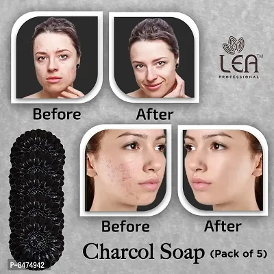 The Natural Wash Charcoal Soap Pack Of 5