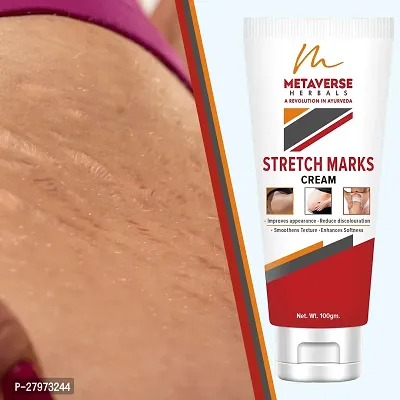 Stretch mark fading cream| Stretch mark minimizer | Stretch mark repair cream | Anti-stretch mark body butter | Stretch mark cream for men  | Stretch  Mark Prevention Oil.-thumb0