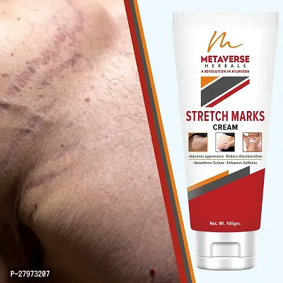 Postpartum Stretch Mark Cream | Stretch Mark Prevention Oil | Stretch Mark Cream for Men | Anti-Stretch Mark Body Butter | Stretch Mark Treatment |-thumb0