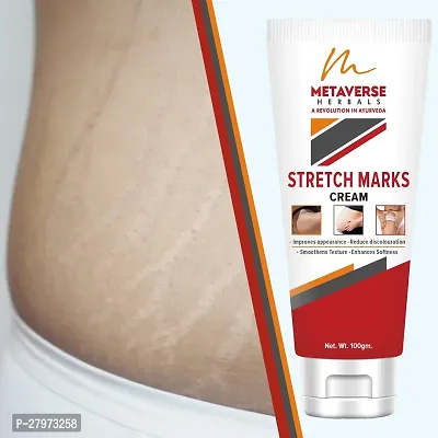 Stretch Mark cream for pregnancy | Stretch Mark lotion | Stretch mark therapy cream | Stretch Mark Creams | Stretch Mark Removal Cream-thumb0