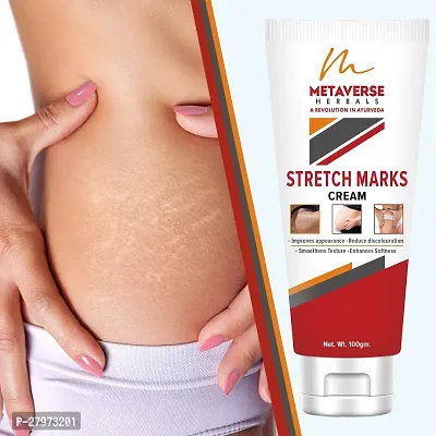 Postpartum Stretch Mark Cream | Stretch Mark Prevention Oil | Stretch Mark Cream for Men | Anti-Stretch Mark Body Butter | Stretch Mark Treatment |-thumb0