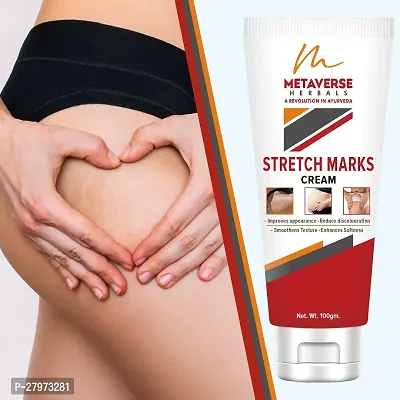 Best stretch mark cream | Pregnancy stretch mark removal | Stretch mark prevention cream | Stretch mark treatment | Natural stretch mark cream.-thumb0