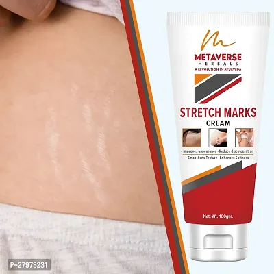 Stretch mark oil | Post-pregnancy stretch mark cream | Effective stretch mark reduction |Stretch mark cream for sensitive skin |Organic stretch mark solution.-thumb0