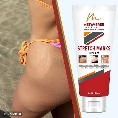 Best stretch mark cream | Pregnancy stretch mark removal | Stretch mark prevention cream | Stretch mark treatment | Natural stretch mark cream.-thumb0