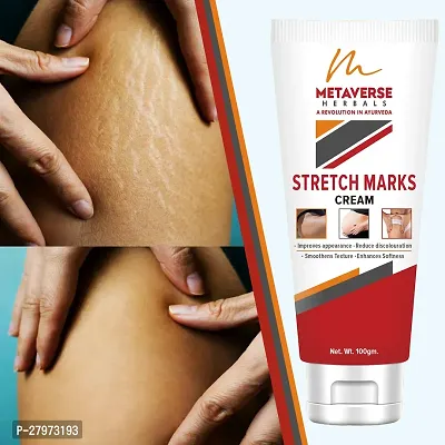 Stretch Mark cream for pregnancy | Stretch Mark lotion | Stretch mark therapy cream | Stretch Mark Creams | Stretch Mark Removal Cream-thumb0