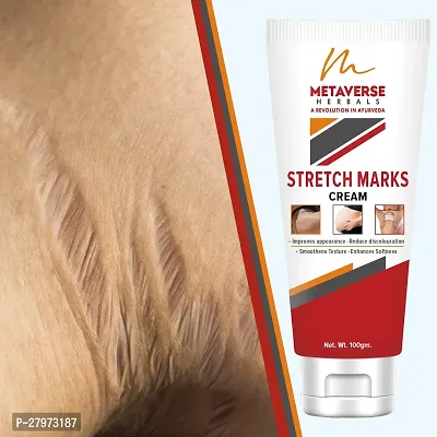 Stretch Mark cream for pregnancy | Stretch Mark lotion | Stretch mark therapy cream | Stretch Mark Creams | Stretch Mark Removal Cream-thumb0