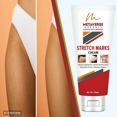 Best stretch mark cream | Pregnancy stretch mark removal | Stretch mark prevention cream | Stretch mark treatment | Natural stretch mark cream.-thumb0