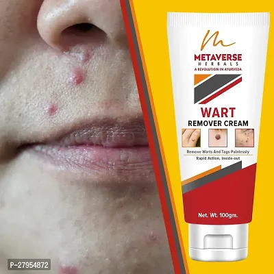 Wart Removal Cream for Men  Women Facial Wart Removal Cream for Skin Care-thumb0