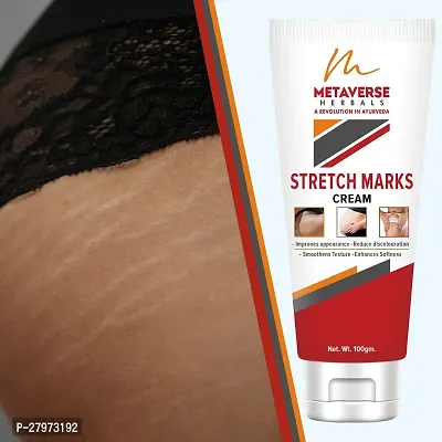 Stretch mark fading cream| Stretch mark minimizer | Stretch mark repair cream | Anti-stretch mark body butter | Stretch mark cream for men  | Stretch  Mark Prevention Oil.-thumb0