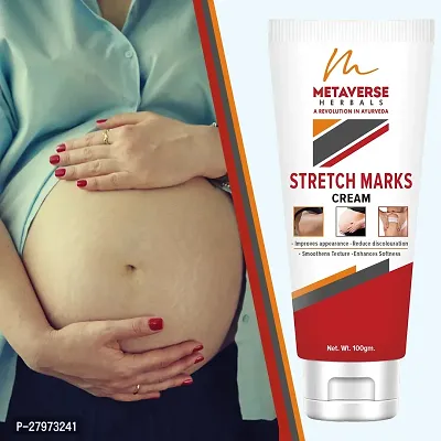 Stretch Marks Cream | Pregnancy Stretch Marks Cream | Anti-stretch mark body butter | Natural stretch mark cream | Stretch mark oil |Stretch Mark Pregnancy Mark Remover | Stretch Marks Scar Removal Cream-thumb0