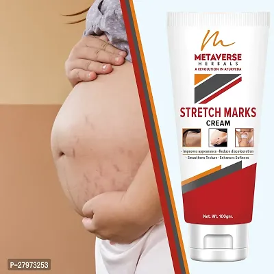 Postpartum Stretch Mark Cream | Stretch Mark Prevention Oil | Stretch Mark Cream for Men | Anti-Stretch Mark Body Butter | Stretch Mark Treatment |