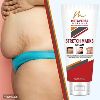 Stretch mark fading cream| Stretch mark minimizer | Stretch mark repair cream | Anti-stretch mark body butter | Stretch mark cream for men  | Stretch  Mark Prevention Oil.-thumb0