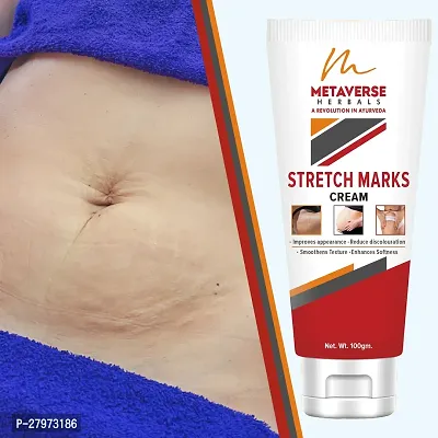 Stretch mark fading cream| Stretch mark minimizer | Stretch mark repair cream | Anti-stretch mark body butter | Stretch mark cream for men  | Stretch  Mark Prevention Oil.-thumb0